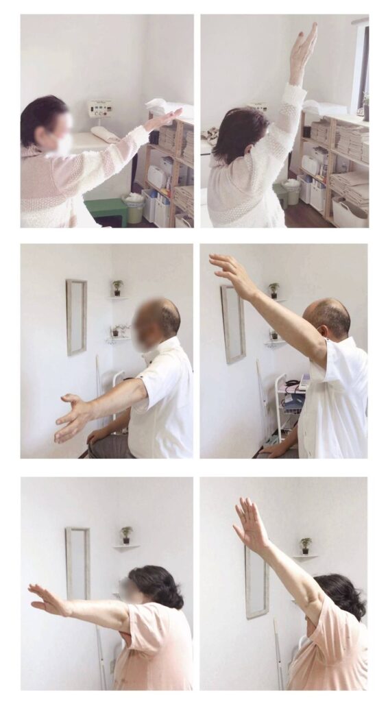 初めて来院された患者様3名の、初回施術前後における腕の可動域の比較画像です。初回1回の施術後に腕の可動域が改善した様子を比較しています。