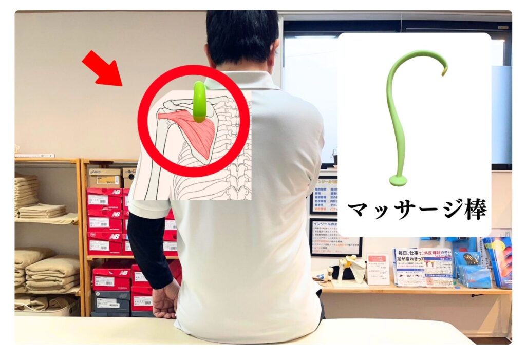 マッサージ棒を使用して五十肩の原因となる肩甲骨の棘下筋をピンポイントでほぐすセルフケアの図解