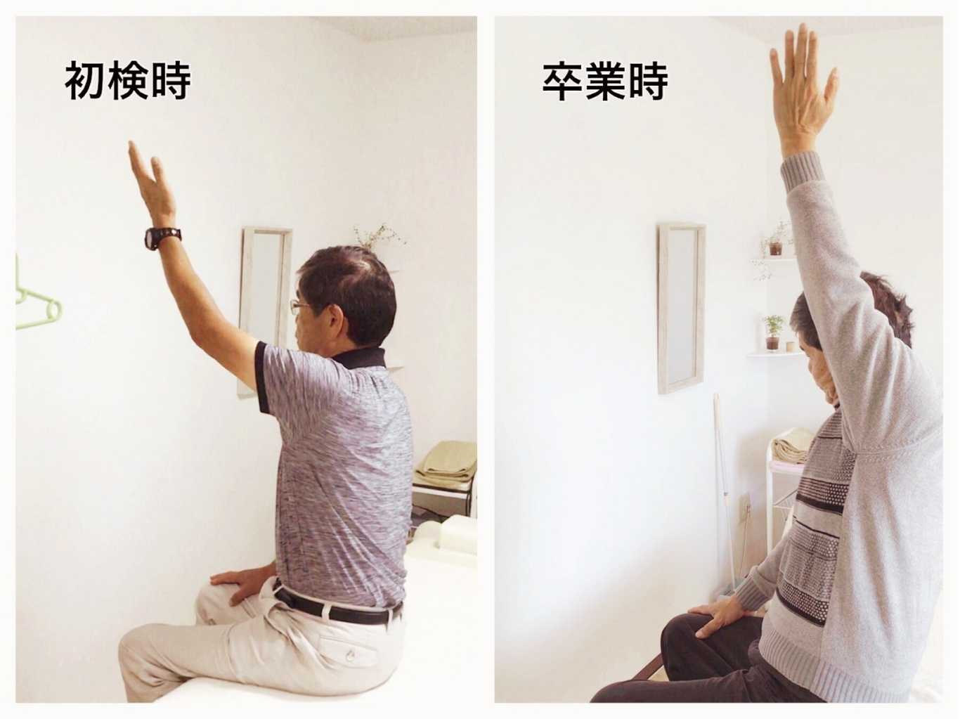 初検時と卒業時を比較した70代の男性患者の写真。座った姿勢での腕の角度が約110°から、施術後の卒業時には真上（約170°）まで上がるよう変化した様子