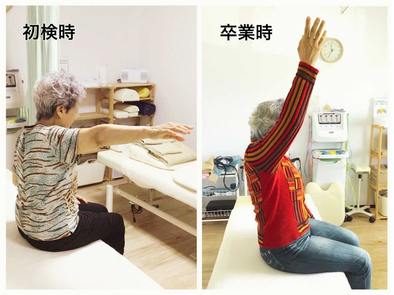 「初検時」と「卒業時」を比較した70代の女性患者様の写真。施術前は腕が約90°にしか上がらなかったのが、卒業時は右腕が真上（180°）まで上がるようになった様子