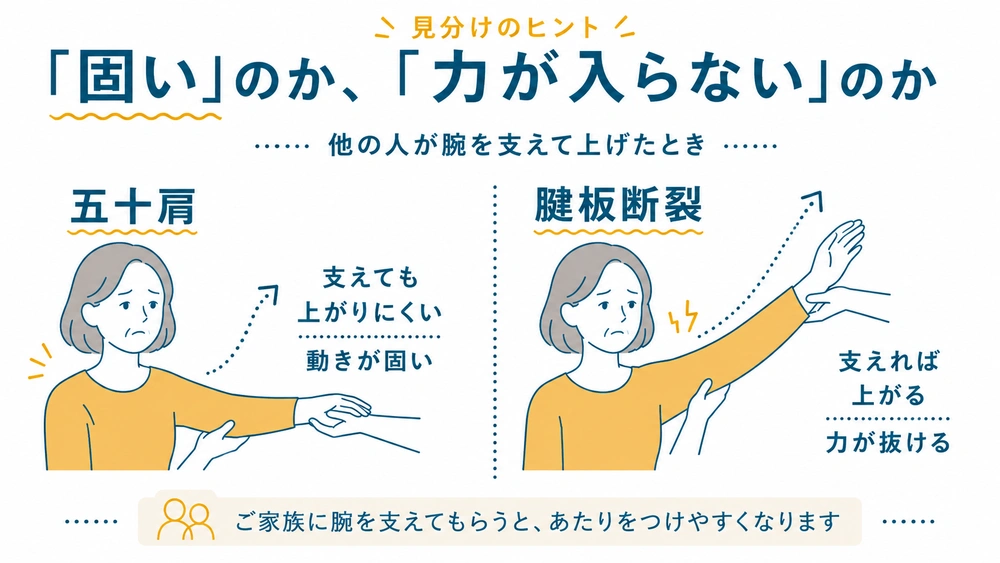 他の人に腕を支えてもらったときの動きを、五十肩と腱板断裂で比較した見分けのヒントを示す図解